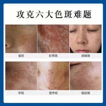 安亞美美白淡斑源OEMODM