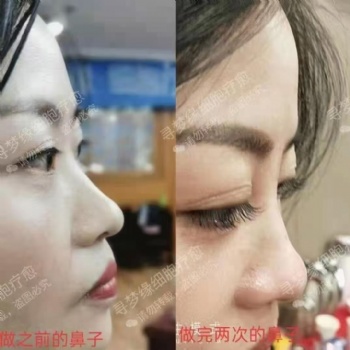 尋夢緣美業 針灸 微整 零成本助你創造百萬業績