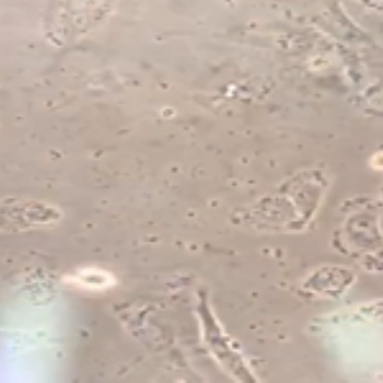 MC38+Luc小鼠結腸癌細胞+Luc智立中特生物